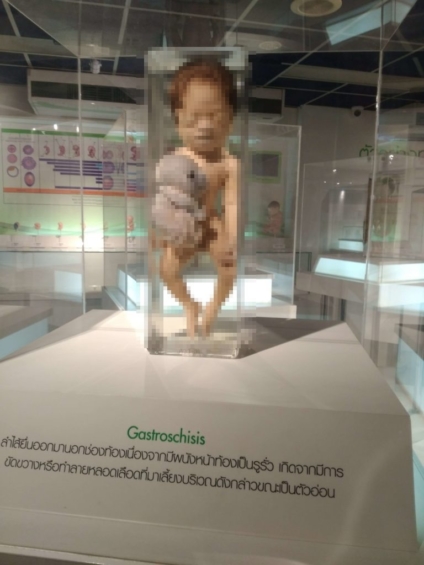 【閲覧注意】シリラートsiriraj病院の死体博物館に行ってみた 雑ログ